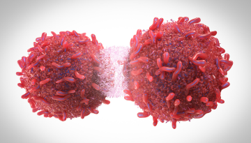 Malignancies Cancer